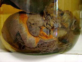 heartworm